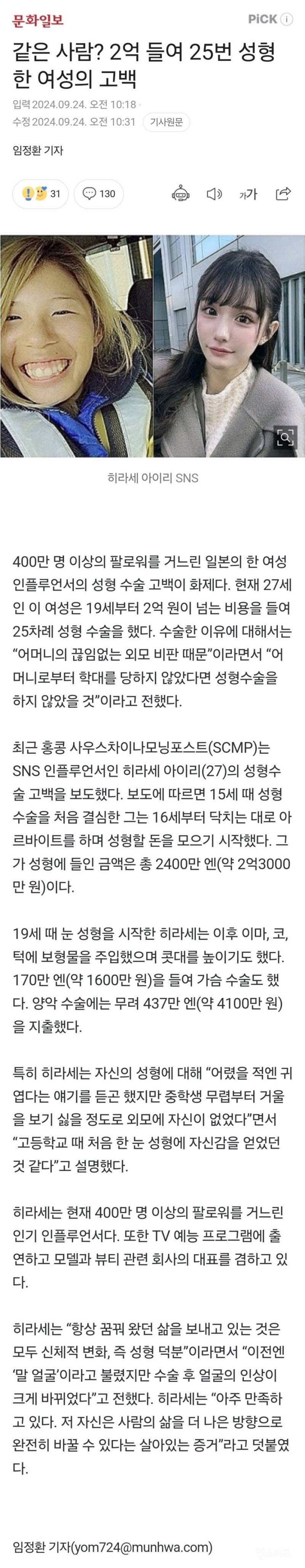 2억 들여서 25번 성형한 여성. jpg | 인스티즈