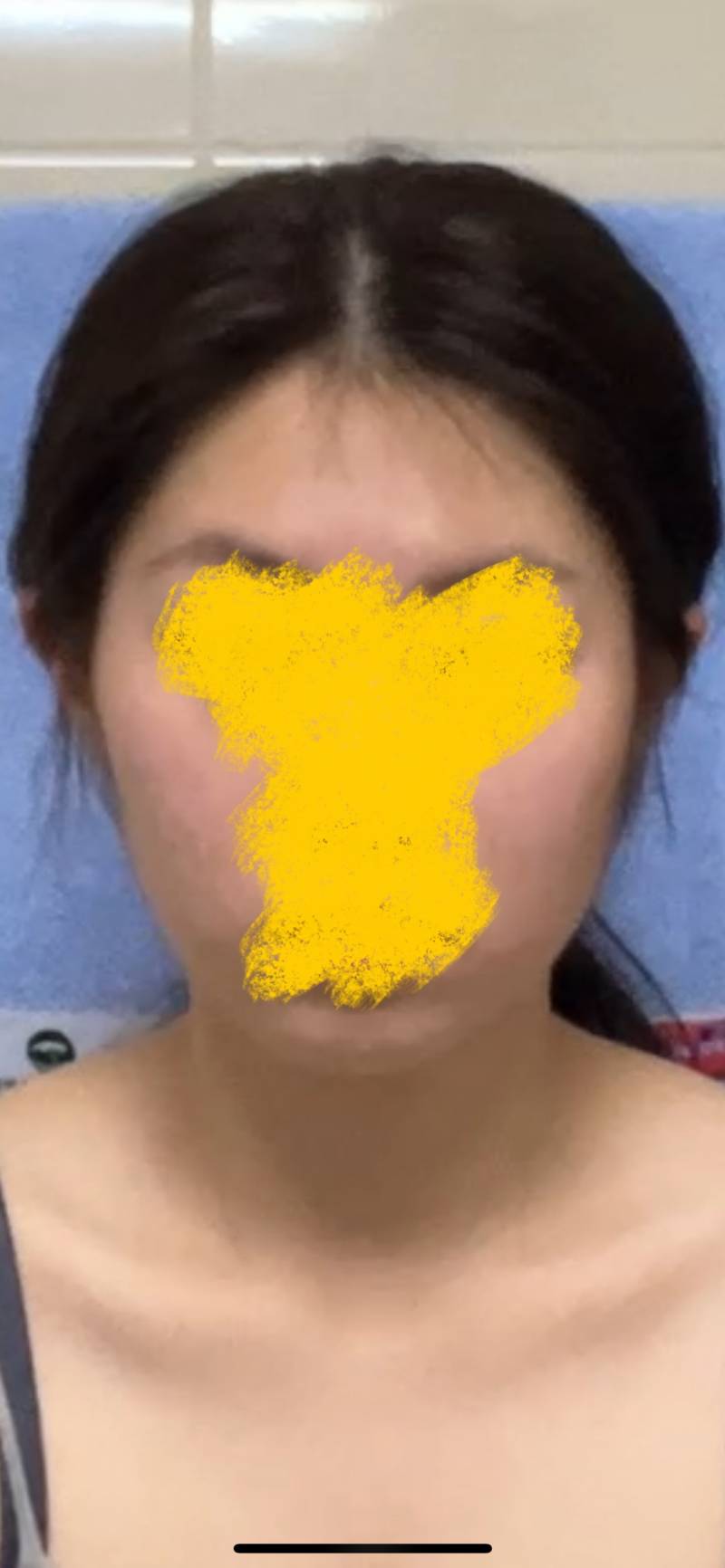 [잡담] 나 볼패임 있지??? | 인스티즈