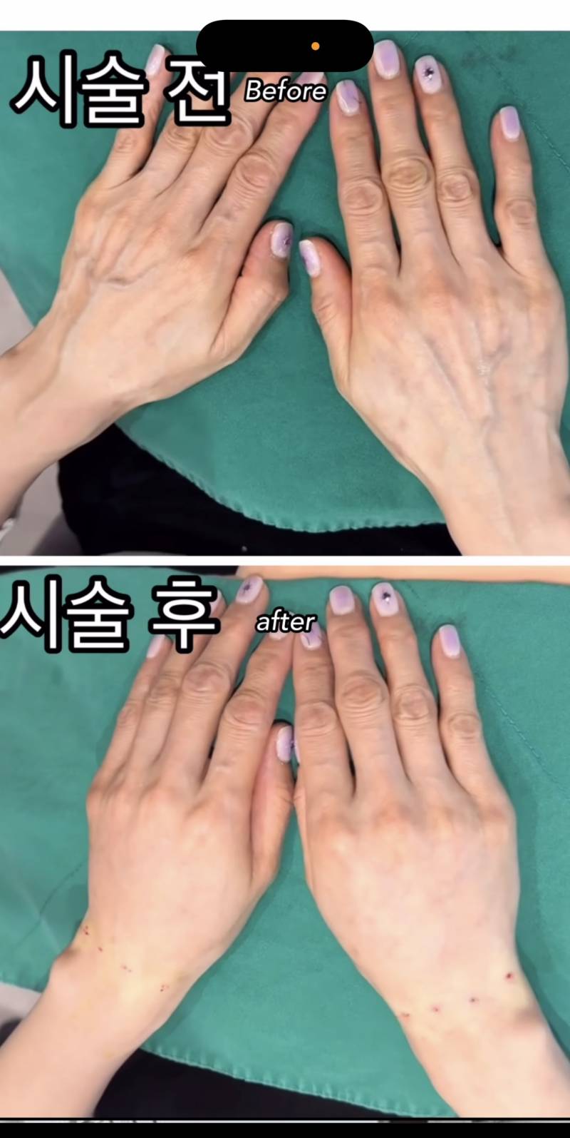 [잡담] 얼굴 아무리 시술해도손은 세월 못 숨긴다고들 했는데 | 인스티즈