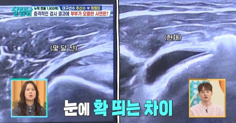 [살림남] 추신수 은퇴 전 몸상태 | 인스티즈