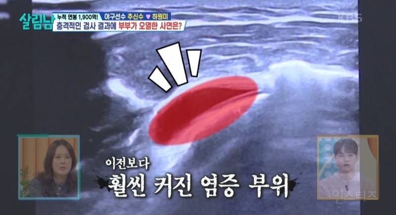 [살림남] 추신수 은퇴 전 몸상태 | 인스티즈