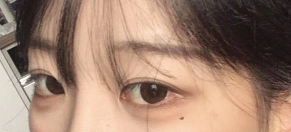 [잡담] 4040 여기서 라인 올려서 쌍수하는거 내 욕심..? | 인스티즈