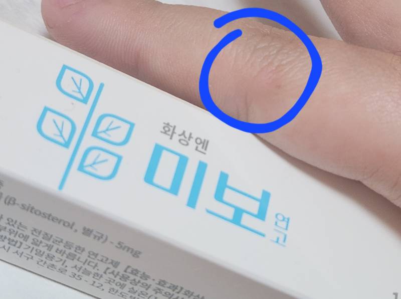 [잡담] 내가 집에 두고 절대 안 없애는 약 알려줄게 개추천 | 인스티즈