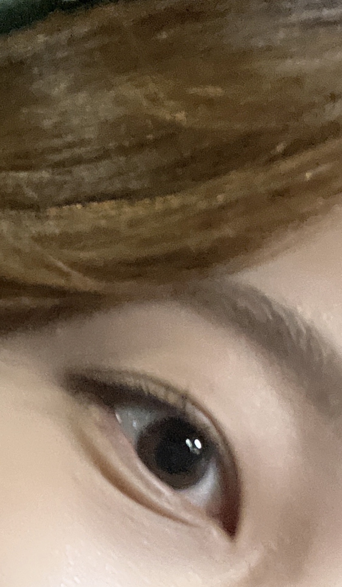 [잡담] 눈밑 선? 주름? 나보다 심한 사람 못본듯... | 인스티즈