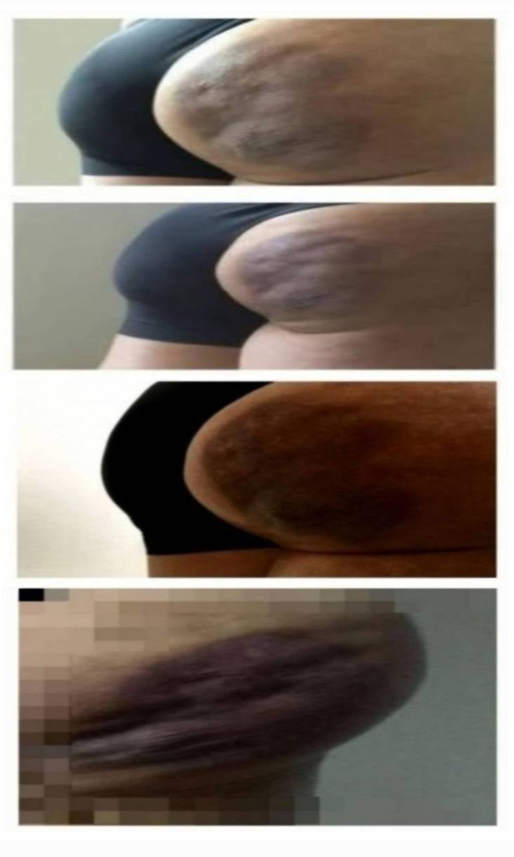 [잡담] 근데 엉덩이괴사가 심한 체벌이야? | 인스티즈