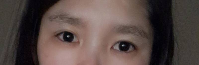 [잡담] 나도 무쌍인데 쌍수 할까말까?ㅠㅠ | 인스티즈