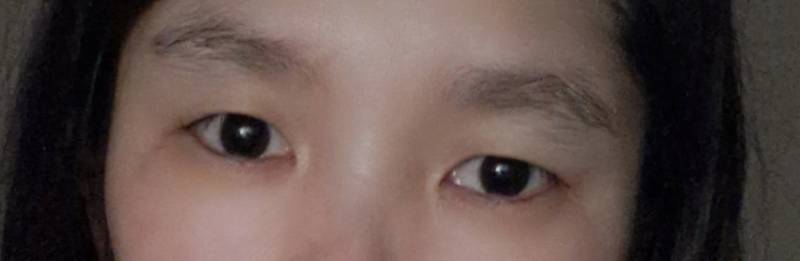 [잡담] 나도 무쌍인데 쌍수 할까말까?ㅠㅠ | 인스티즈