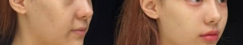 [잡담] 이런 입꼬리 주변 올라가게끔(?)하는건 | 인스티즈