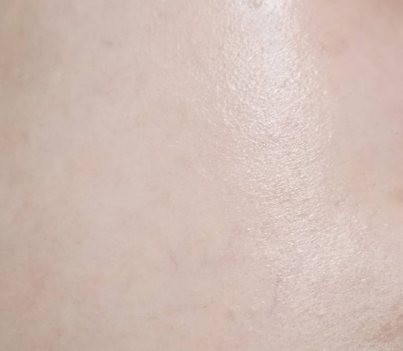 [잡담] 피부가 안 좋은 건 아닌 것 같은데 좋은 것도 아니야 | 인스티즈