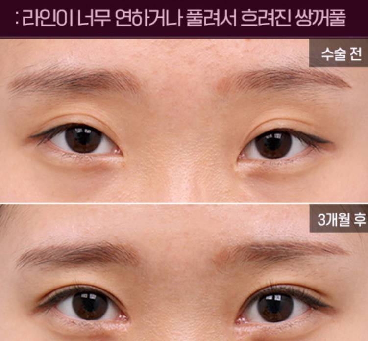 [잡담] 이거 눈 안이뻐? | 인스티즈