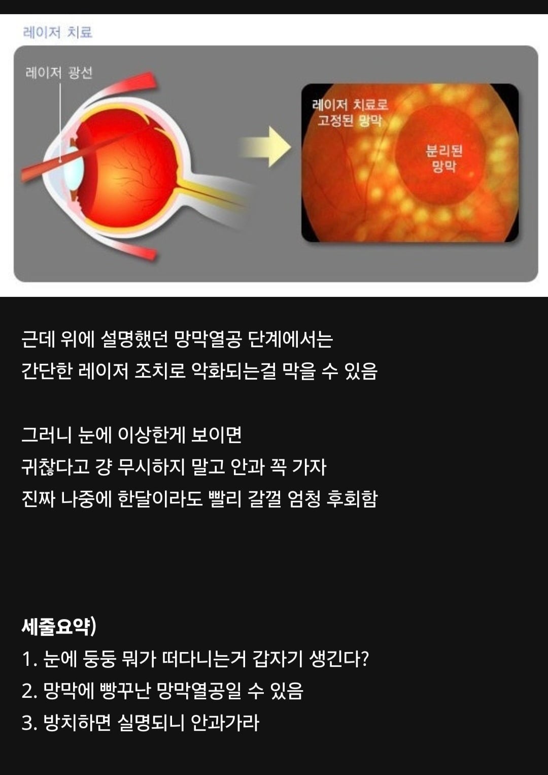 방치하면 실명까지 갈 수 있는 망막열공 자가 진단 방법.jpg | 인스티즈