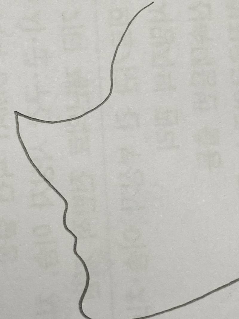 [잡담] 코난 전 후 비교 | 인스티즈