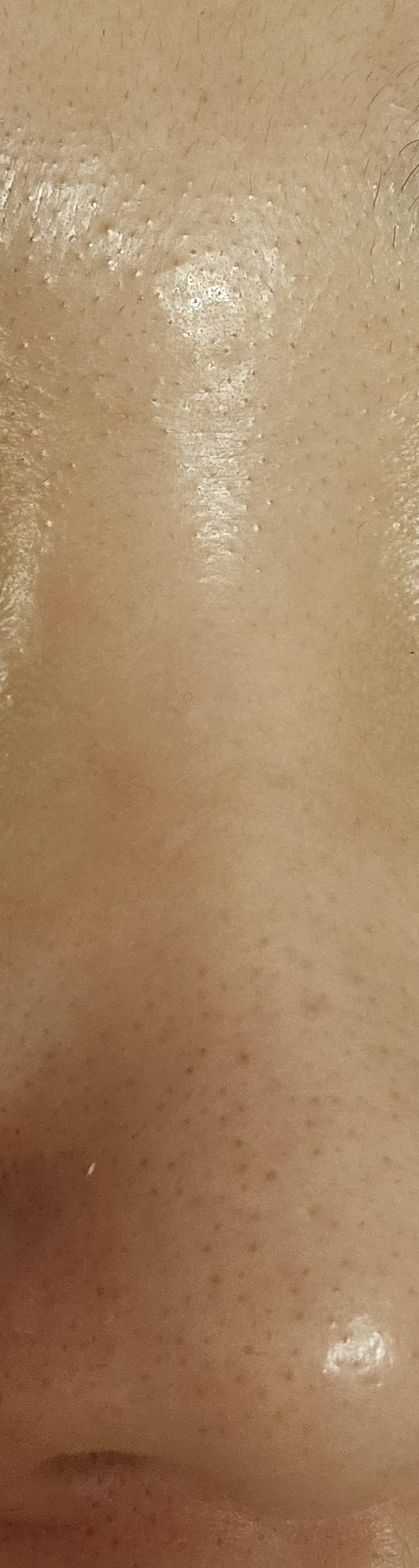 [잡담] (혐) 이런 피지? 요철?은 어케 관리해야 되나요... | 인스티즈
