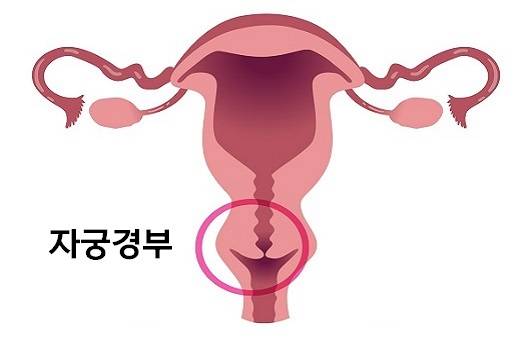 소변 본 뒤...콧물처럼 길게 늘어지는 분비물의 정체 | 인스티즈