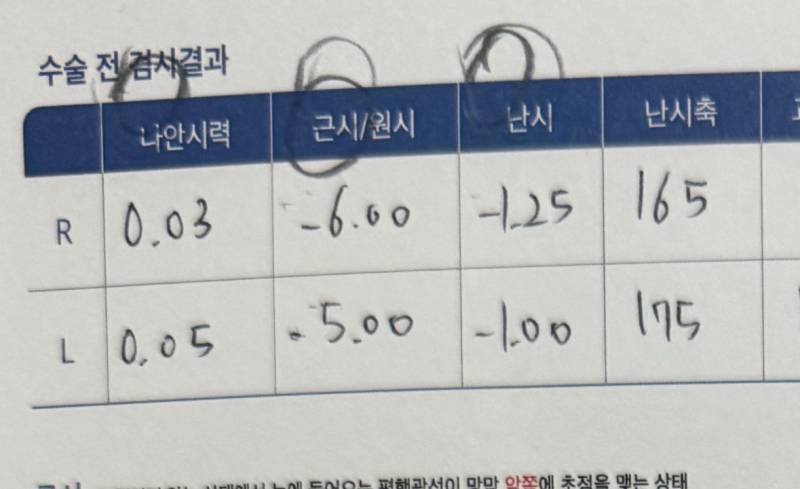 [잡담] 내시력이 나안시력인거야? 시력 말할때 나안으로 말하면 돼? | 인스티즈