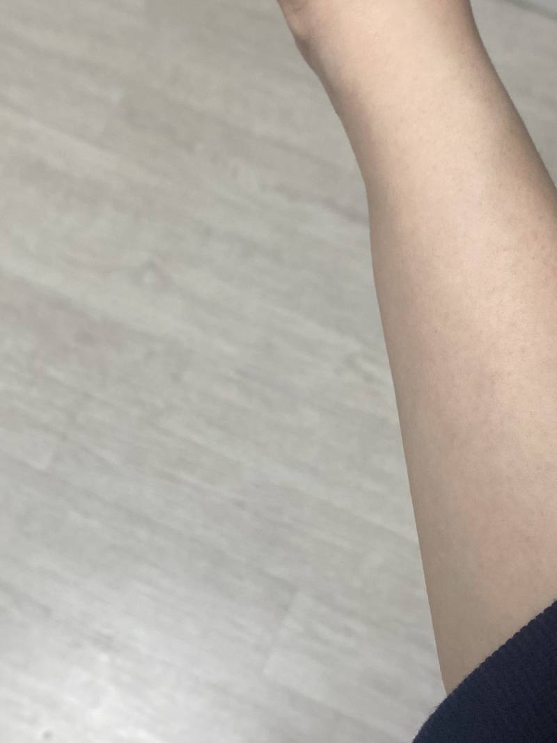 [잡담] 나 팔뚝? 팔살? 이런데 왜 이런걸까 진짜 절대 안 빠짐 | 인스티즈