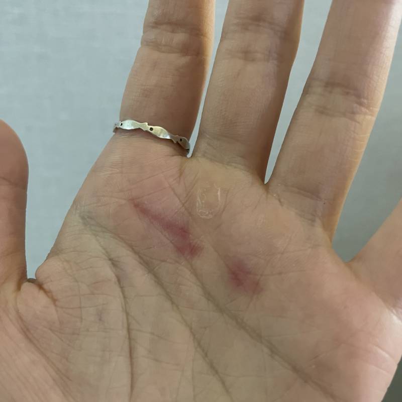 [잡담] 모지 이거 손바닥에 갑자기 상처 생긴 건가? | 인스티즈