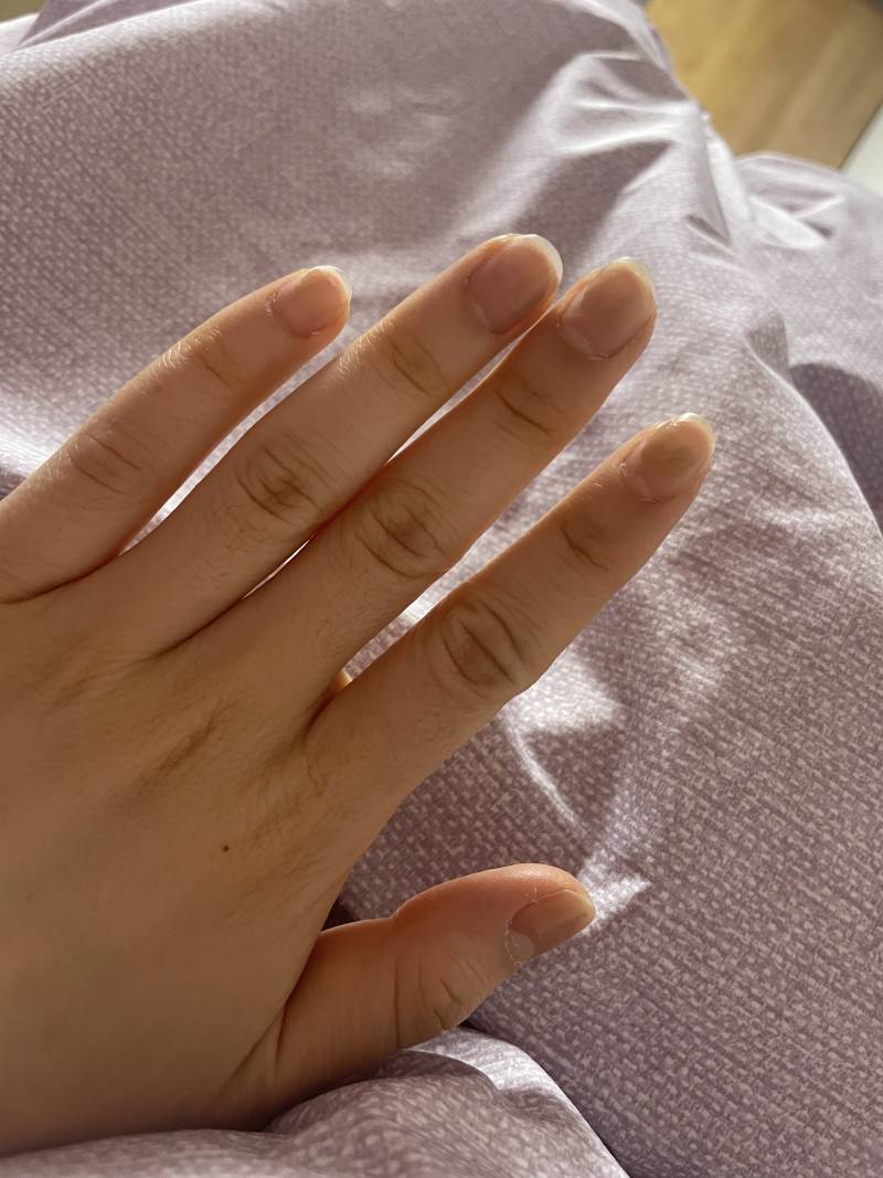 [잡담] 나 손 개못생김 젤네일받아볼까?? | 인스티즈