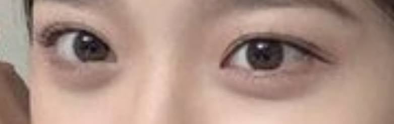 [잡담] 이런 도톰한 애교살은 타고나는 건가?? | 인스티즈