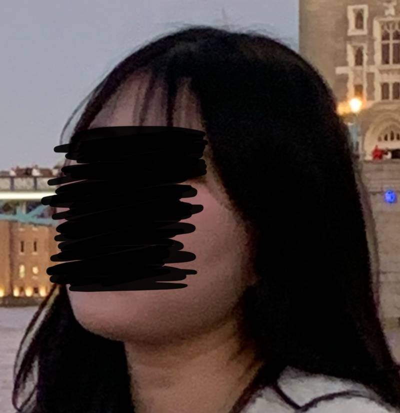 [잡담] 성형수술 예약했는데 할까말까 고민좀 들어주라ㅠㅜ | 인스티즈