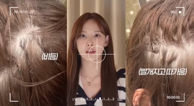 이나연이 얘기하는 두피관리방법.jpg | 인스티즈