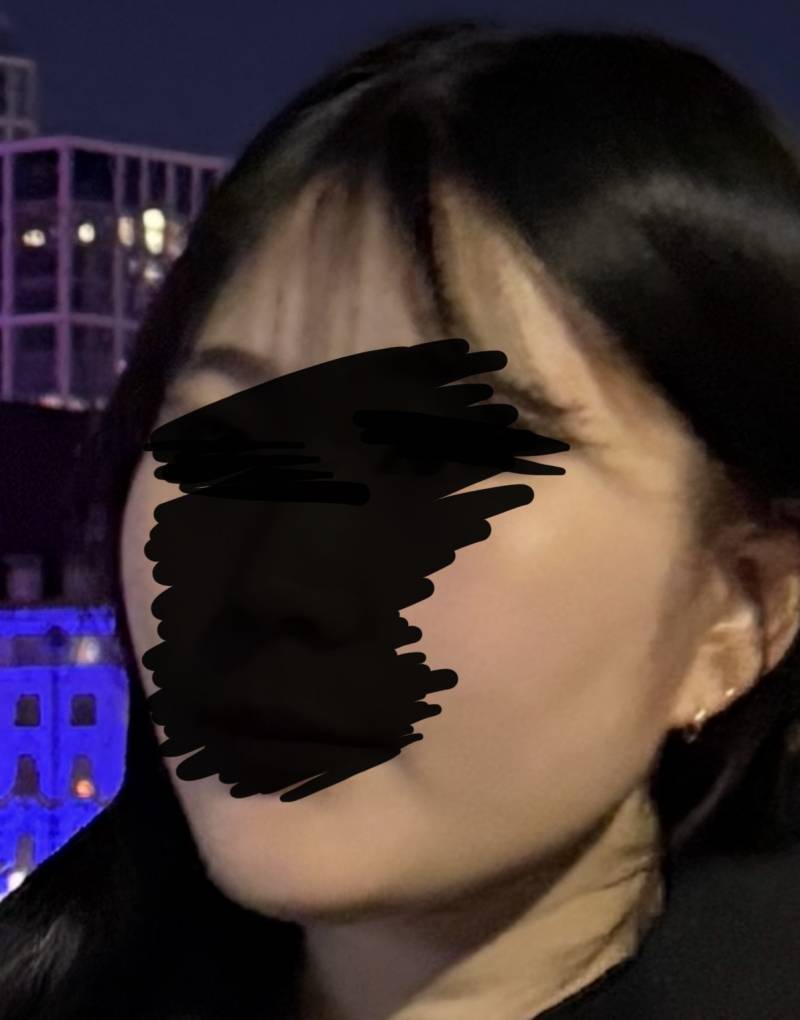 [잡담] 지흡 예약했는데 할까 말까 너무 고민되어.. | 인스티즈
