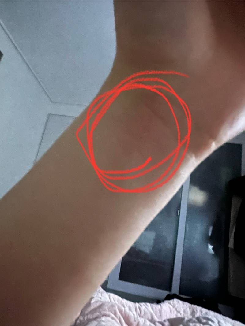 [잡담] 손목이 갑자기 아픈디... | 인스티즈