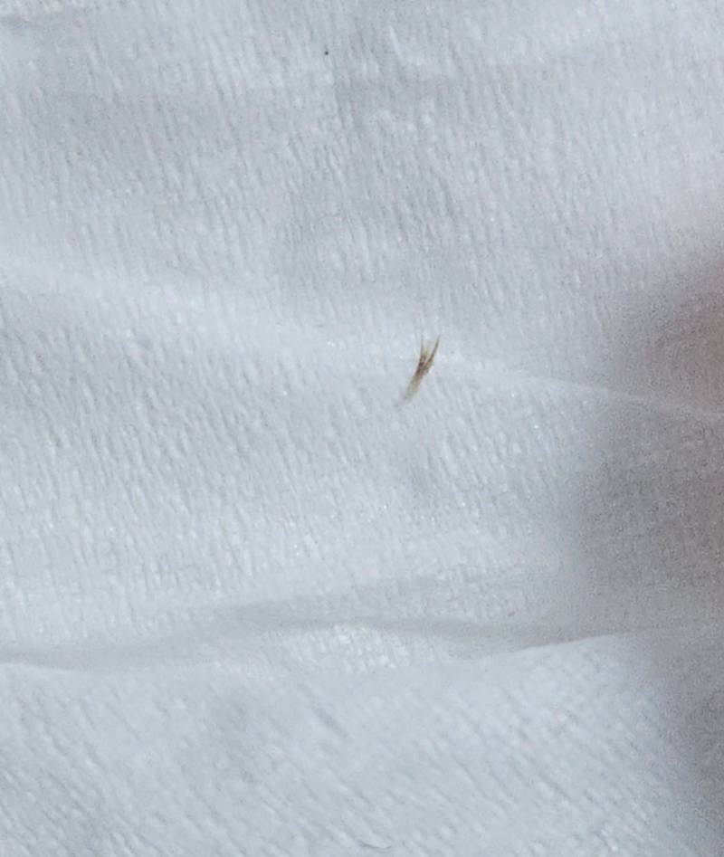 [잡담] (혐오주의) 얼굴에서 뽑았는데 이거뭐야? | 인스티즈