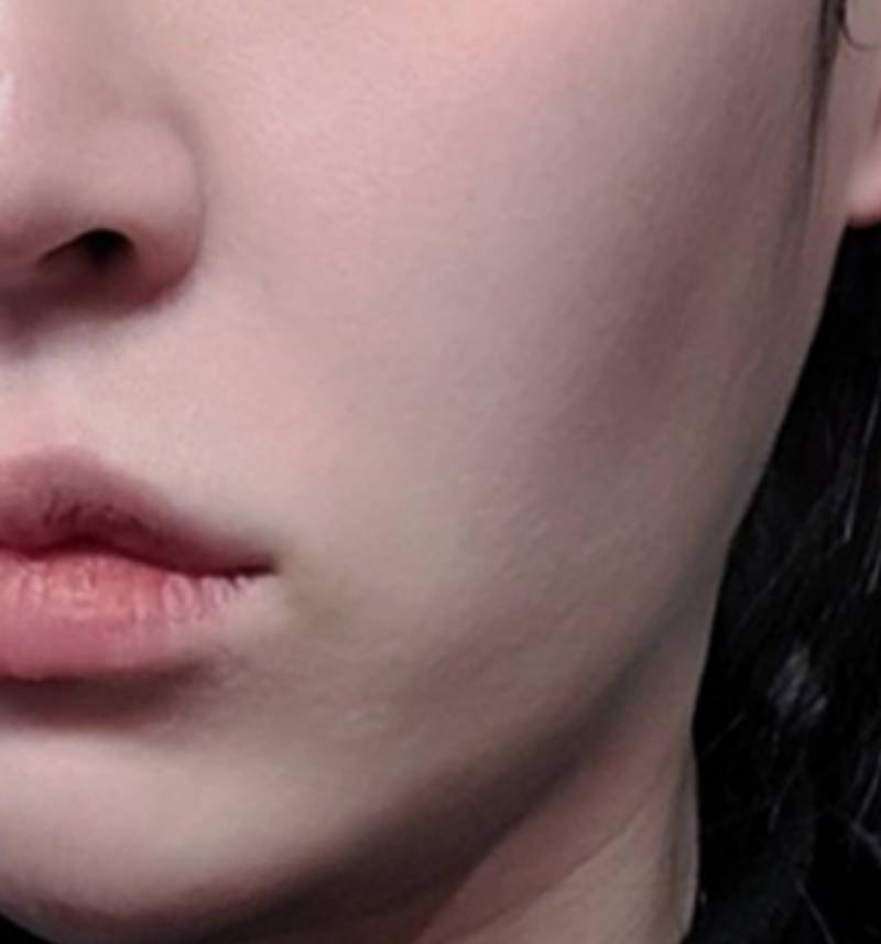 [잡담] 와 이게 볼패임 부작용이었구나.. | 인스티즈