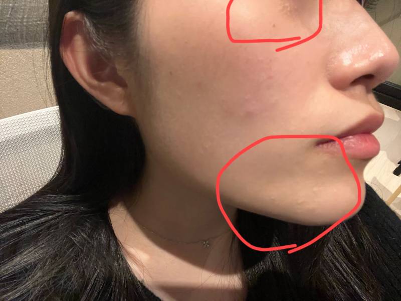 [잡담] 피부 박사 선생님들,, | 인스티즈
