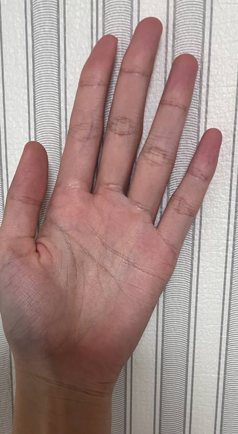 [잡담] 내 손 뭔가 이상하게 생겼어 | 인스티즈