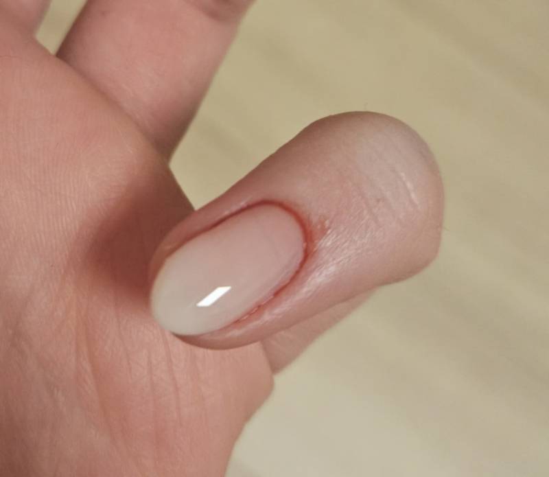 [잡담] 네일 받다가 피났는데ㅠㅠ | 인스티즈