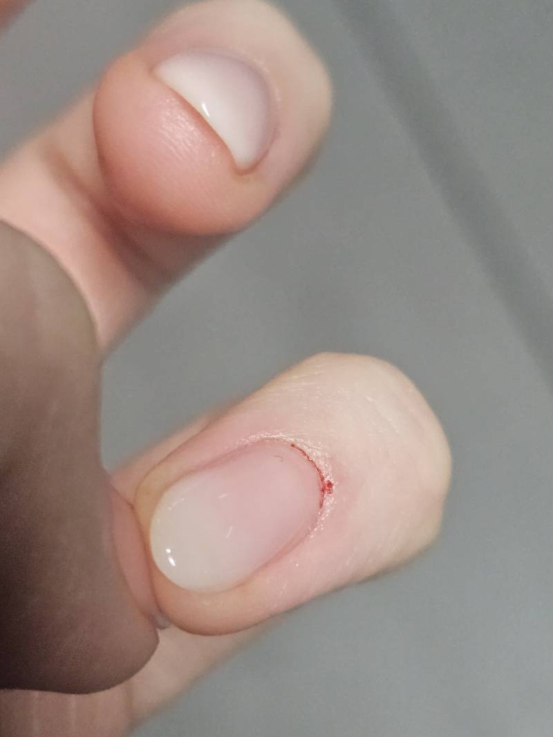 [잡담] 네일 받다가 피났는데ㅠㅠ | 인스티즈