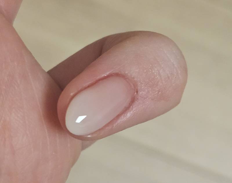 [잡담] 네일 받다가 피났는데ㅠㅠ | 인스티즈