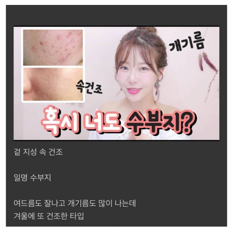 피부과에서도 절레절레한다는 피부.JPG | 인스티즈