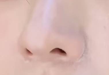 [잡담] 코 옆에 푹 파인 사람 있어? | 인스티즈