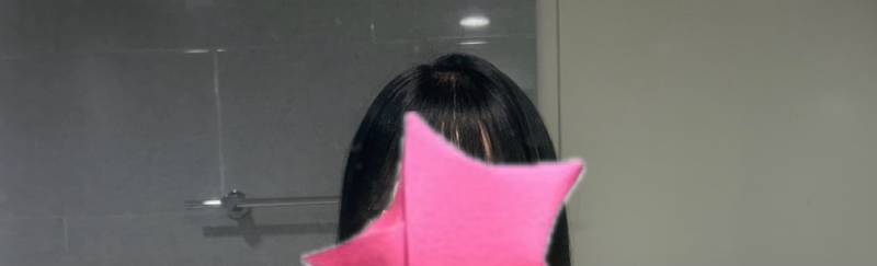 [잡담] 탈모 같은지 다시 봐주라잉 ㅠㅠㅠㅠㅠㅠㅠㅠ | 인스티즈