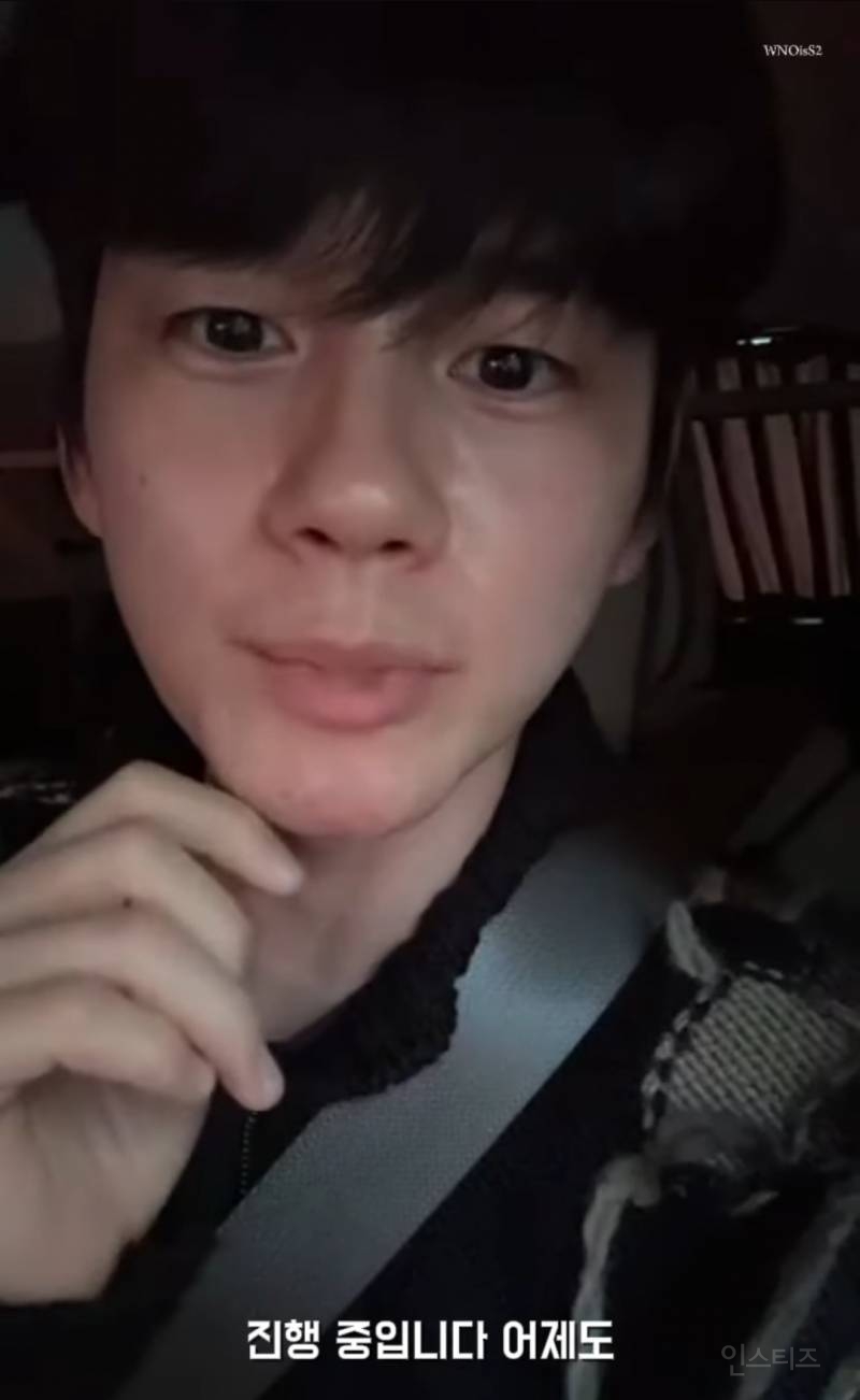 어제자 라방에서 레이저제모썰 푸는 연옌 | 인스티즈
