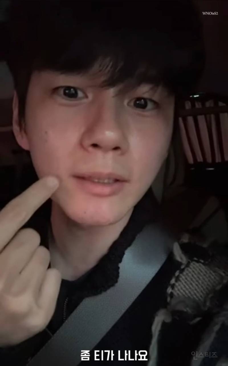 어제자 라방에서 레이저제모썰 푸는 연옌 | 인스티즈