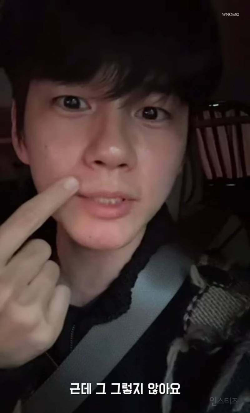 어제자 라방에서 레이저제모썰 푸는 연옌 | 인스티즈