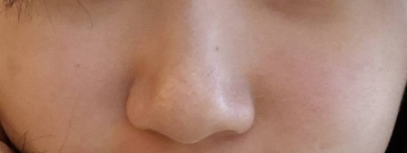 [잡담] 나 피부 안좋았다가 좋아짐 | 인스티즈