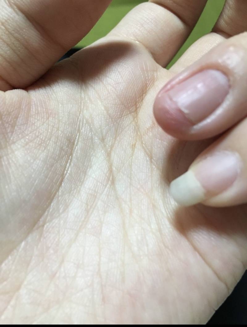 [잡담] 손톱 자를까 말까 | 인스티즈