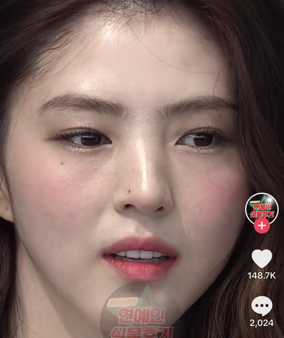 [마플] 이런거 보면 연예인이라고 다 피부가 좋진 않구나 | 인스티즈