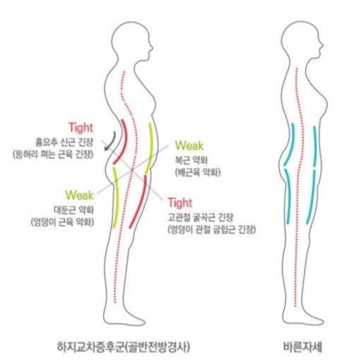 [잡담] 왼쪽 나잖아...? | 인스티즈