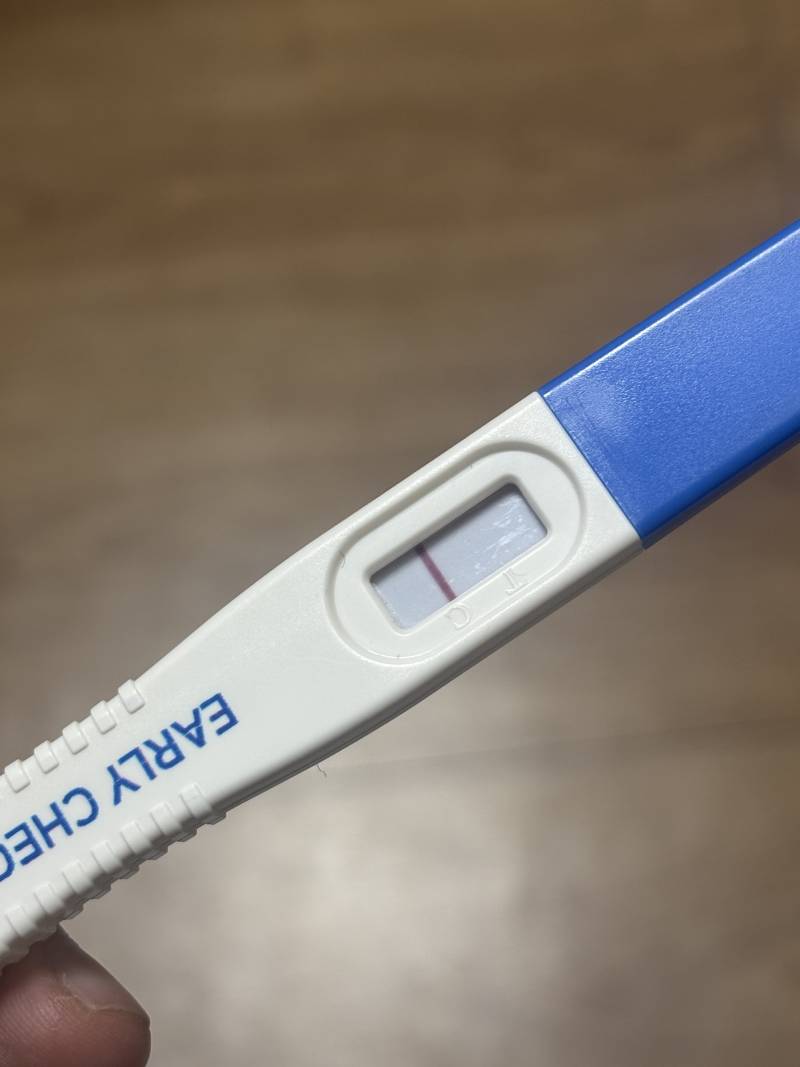 [잡담] 매직아이 잘 보는 익들 들어와봐 | 인스티즈