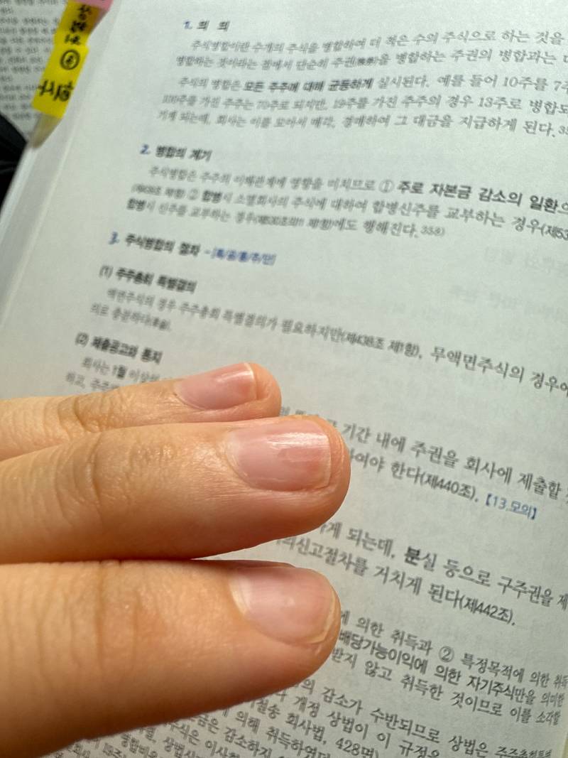 [잡담] 젤네일 제거 받았는데 사장이 손톱을 미친듯이 갈아놨어 하 | 인스티즈