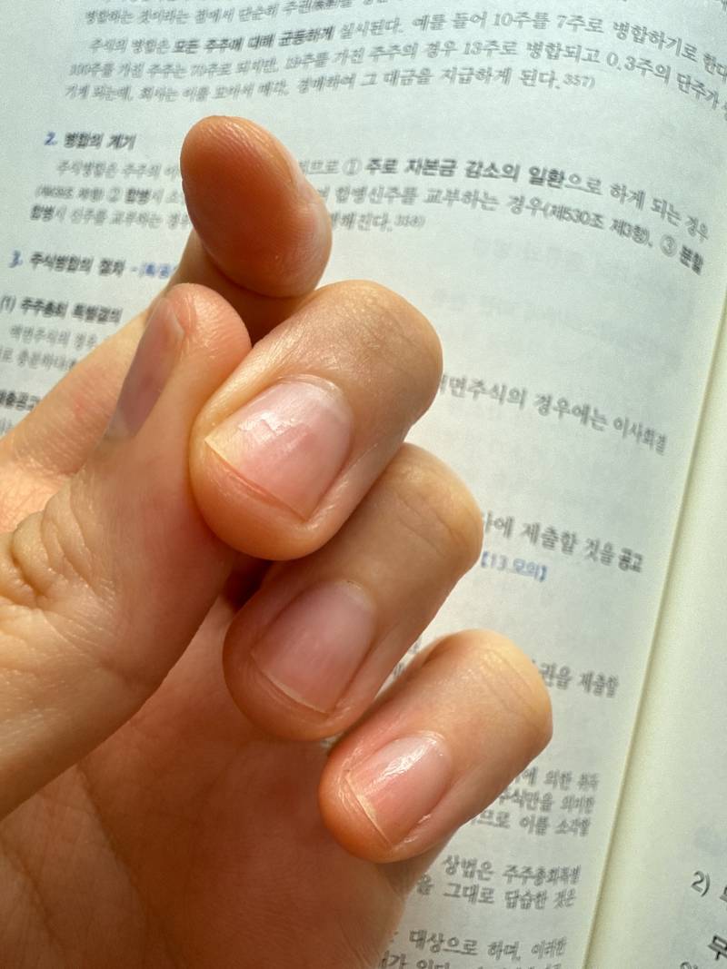 [잡담] 젤네일 제거 받았는데 사장이 손톱을 미친듯이 갈아놨어 하 | 인스티즈