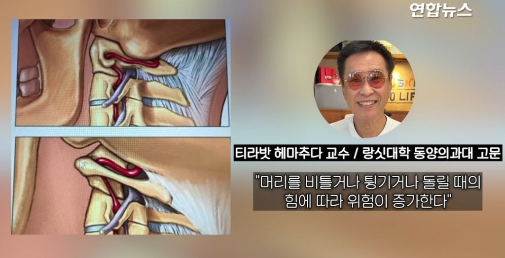 태국서 목 비트는 마사지 받은 가수, 전신마비 끝 숨져.. | 인스티즈