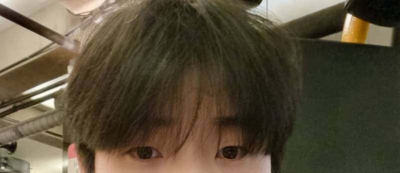 [잡담] 남잔데 눈성형 하는거 어떻게 생각해? | 인스티즈