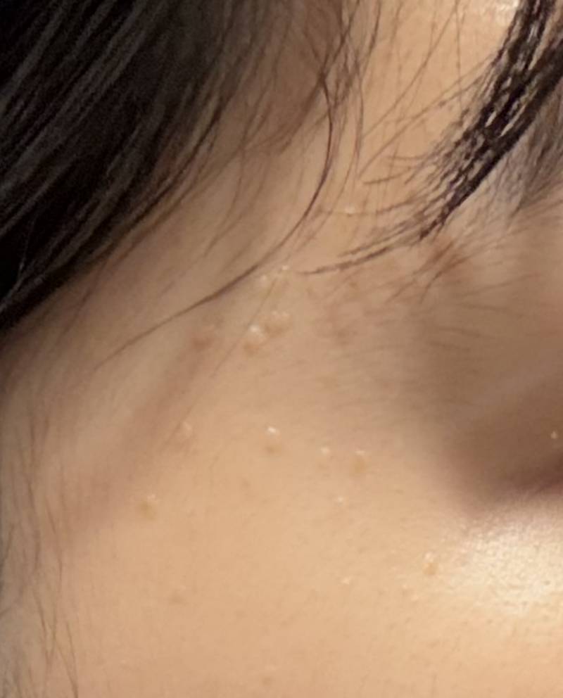 [잡담] 피부에 이거 뭘까? | 인스티즈